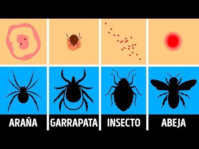 picadura de polilla en humanos
